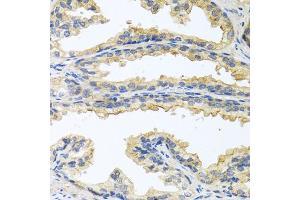 Immunohistochemistry of paraffin-embedded human prostate using OSM antibody. (Oncostatin M antibody)