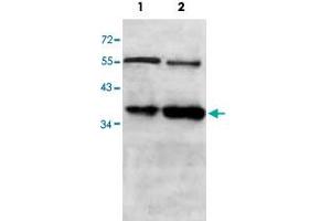 Western blot analysis of SW480 (Lane 1) and MDA-MB-231 (Lane 2) lysate with ANXA2 polyclonal antibody  at 1 : 500 dilution. (Annexin A2 antibody  (AA 177-329))