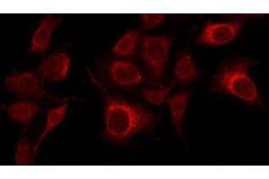 ABIN6268914 staining LOVO by IF/ICC. (RAN antibody  (C-Term))