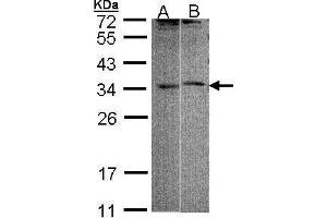 WB Image Sample (30 ug of whole cell lysate) A: 293T B: Raji 12 % SDS PAGE antibody diluted at 1:1000 (FHL5 antibody)