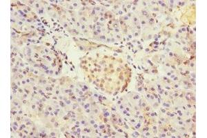 Immunohistochemistry of paraffin-embedded human pancreatic tissue using ABIN7149054 at dilution of 1:100 (CRIP2 antibody  (AA 1-208))