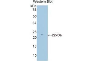 Western blot analysis of the recombinant protein. (Lymphocyte Function Associated Antigen 2 (AA 27-203) antibody)
