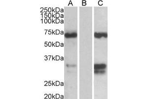 Western Blotting (WB) image for Forkhead Box C2 (MFH-1, Mesenchyme Forkhead 1) (FOXC2) peptide (ABIN370423)