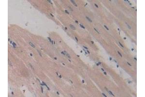 Detection of GP9 in Rat Heart Tissue using Polyclonal Antibody to Glycoprotein IX, Platelet (GP9) (CD42a antibody  (AA 1-189))