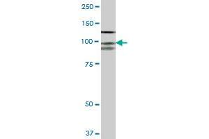 CDH3 MaxPab polyclonal antibody. (P-Cadherin antibody  (AA 1-829))