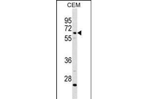 C8B Antibody (C-term) (ABIN1881130 and ABIN2838764) western blot analysis in CEM cell line lysates (35 μg/lane). (C8B antibody  (C-Term))