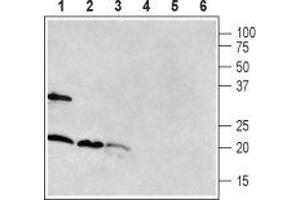 Western blot analysis of rat brain (lanes 1 and 4), mouse brain (lanes 2 and 5) and rat pancreas (lanes 3 and 6): - 1-3. (RAMP1 antibody  (Extracellular, N-Term))