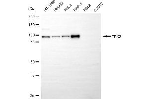Western blotting analysis using TPX2 antibody (ABIN7800579). (Recombinant TPX2 antibody)