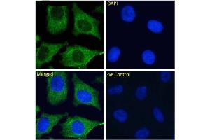 Immunofluoresence staining of fixed HeLa cells with anti-DC-SIGNR antibody 16E7. (Recombinant C-Type Lectin Domain Family 4, Member M (CLEC4M) antibody)