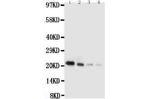 Anti-mouse IL18 antibody, Western blotting Lane 1: Recombinant Mouse IL18 Protein 10ng Lane 2: Recombinant Mouse IL18 Protein 5ng Lane 3: Recombinant Mouse IL18 Protein 2