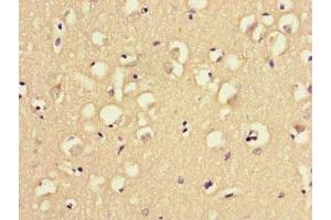Immunohistochemistry of paraffin-embedded human brain tissue using ABIN7159790 at dilution of 1:100 (MAST1 antibody  (AA 687-879))