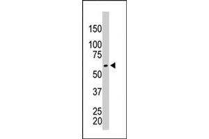 The PKM2 polyclonal antibody  is used in Western blot to detect PKM2 in HeLa cell lysate . (PKM2 antibody  (AA 483-513))