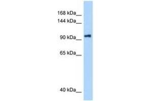 DHX16 anticorps  (AA 171-220)