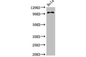Western Blot Positive WB detected in: Hela whole cell lysate All lanes: PIK3C3 antibody at 3. (PIK3C3 antibody  (Catalytic Subunit))