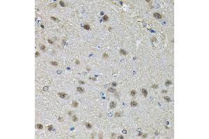 Immunohistochemistry of paraffin-embedded mouse brain using PPID Antibody (ABIN5974177) at dilution of 1/100 (40x lens).