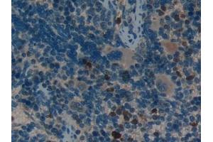 Immunohistochemistry (IHC) image for anti-Leukemia Inhibitory Factor Receptor alpha (LIFR) (AA 152-291) antibody (ABIN7432040)
