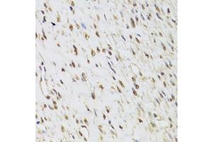 Immunohistochemistry of paraffin-embedded human leiomyoma of uterus using SEPHS1 Antibody. (SEPHS1 antibody)