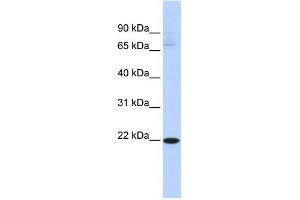 WB Suggested Anti-RBPMS2 Antibody Titration:  0. (RBPMS2 antibody  (Middle Region))