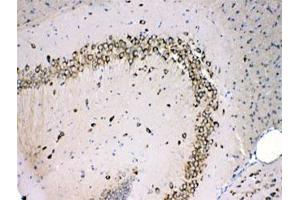 IHC testing of FFPE mouse brain with MPS1 antibody at 1ug/ml.