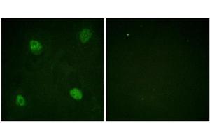 Immunofluorescence staining of methanol-fixed HeLa cells using hnRPD (Phospho-Ser83) Antibody. (HNRNPD/AUF1 antibody  (pSer83))