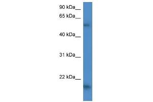 GPT2 antibody used at 1 ug/ml to detect target protein.