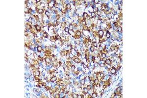 Immunohistochemistry of paraffin-embedded Rat ovary using [KO Validated] CHCHD2 Rabbit pAb (ABIN7266448) at dilution of 1:100 (40x lens). (CHCHD2 antibody  (AA 75-145))