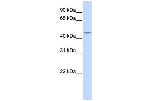 WB Suggested Anti-HSFY1 Antibody Titration:  0. (HSFY1 antibody  (Middle Region))