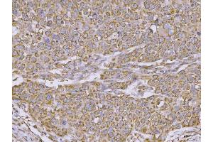 IHC analysis of CLASP1 using anti-CLASP1 antibody (ABIN7599144). (CLASP1 antibody  (AA 1-243))