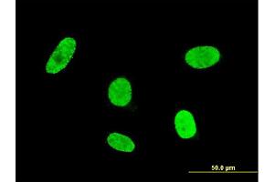 Immunofluorescence (IF) image for anti-Goosecoid Homeobox (GSC) (AA 151-257) antibody (ABIN530879)