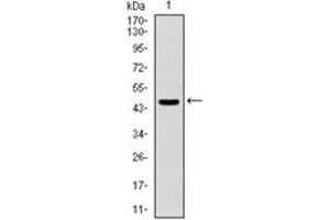 Western Blotting (WB) image for anti-Argininosuccinate Synthase 1 (ASS1) antibody (ABIN1105455)
