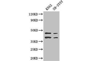 Western Blot Positive WB detected in: K562 whole cell lysate, SH-SY5Y whole cell lysate All lanes: AIM2 antibody at 2. (AIM2 antibody  (AA 81-326))