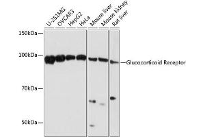 Western blot analysis of extracts of various cell lines, using Glucocorticoid Receptor antibody (ABIN7269016) at 1:1000 dilution. (Glucocorticoid Receptor antibody)