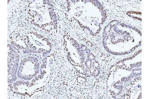 IHC analysis of MCM6 using anti-MCM6 antibody (ABIN7600037).
