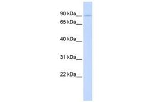 Image no. 1 for anti-LON Peptidase N-terminal Domain and Ring Finger 2 (LONRF2) (AA 612-661) antibody (ABIN6743183) (LONRF2 antibody  (AA 612-661))