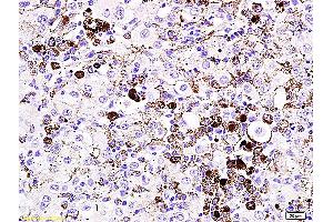 MITF antibody  (AA 351-450)