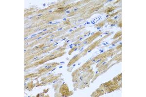 Immunohistochemistry of paraffin-embedded rat heart using MOK antibody. (MOK antibody)