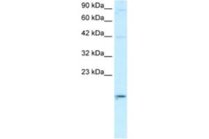 Western Blotting (WB) image for anti-Apolipoprotein B mRNA Editing Enzyme, Catalytic Polypeptide-Like 3G (APOBEC3G) antibody (ABIN2460746) (APOBEC3G antibody)