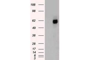 HEK293T cells were transfected with the pCMV6-ENTRY control (Left lane) or pCMV6-ENTRY CHEK2 (Right lane) cDNA for 48 hrs and lysed. (CHEK2 antibody)