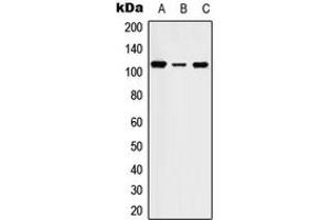 Western blot analysis of STK31 expression in HEK293T (A), SP2/0 (B), PC12 (C) whole cell lysates.