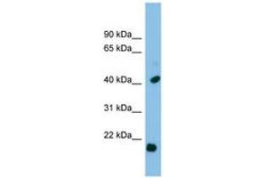 Image no. 1 for anti-Heat Shock 27kDa Protein 2 (HSPB2) (C-Term) antibody (ABIN6744849) (HSPB2 antibody  (C-Term))