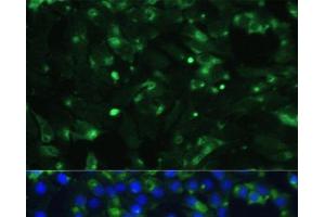 Immunofluorescence analysis of C6 cells using ENO1 Polyclonal Antibody at dilution of 1:100. (ENO1 antibody)