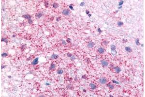 Anti-CRF1 antibody  ABIN1048460 IHC staining of rat hypothalamus. (CRHR1 antibody  (N-Term))