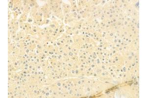 ABIN6263330 and ABIN6279544 at 1/100 staining human normal lung tissue by IHC-P.