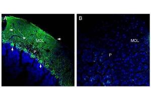Expression of SLC38A1 in rat cerebellum. (SLC38A1 antibody  (Cytosolic))