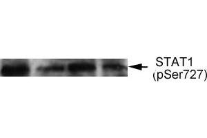 Western blot analysis of extract from thyroid cancer cell line Bph cells, using STAT1 (phospho-Ser727) antibody (E011163). (STAT1 antibody  (pSer727))
