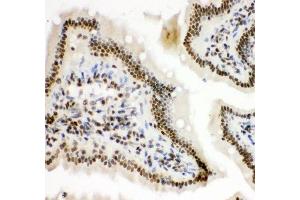 IHC-P: HIF-1-alpha antibody testing of mouse intestine tissue (HIF1A antibody  (AA 703-732))
