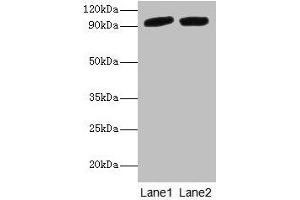 Western blot All lanes: POSTN antibody at 2 μg/mL Lane 1: Mouse liver tissue Lane 2: Hela whole cell lysate Secondary Goat polyclonal to rabbit IgG at 1/10000 dilution Predicted band size: 94, 88, 84, 91, 81 kDa Observed band size: 94 kDa (Periostin antibody  (AA 24-836))