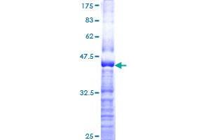 Image no. 1 for Sema Domain, Immunoglobulin Domain (Ig), Short Basic Domain, Secreted, (Semaphorin) 3A (SEMA3A) (AA 672-770) protein (GST tag) (ABIN1319459)