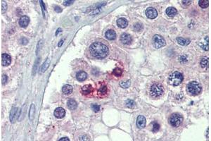 Testis, Human: Formalin-Fixed, Paraffin-Embedded (FFPE) (STAT5B antibody  (N-Term))