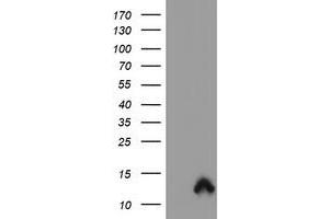 Image no. 1 for anti-S100 Calcium Binding Protein P (S100P) antibody (ABIN1500789) (S100P antibody)